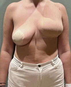 AISO Breast Tape 10cm Cino