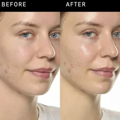 Ectoin Hydro-Barrier Serum - Fugtende og beskyttende serum