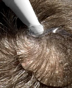 Hair Activator - Hårstimulerende serum