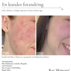 Raz Skincare Repair Salve 15 ml