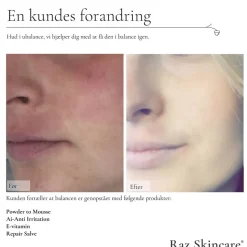 Raz Skincare Repair Salve 15 ml