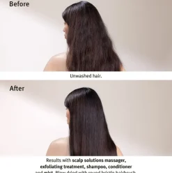 Scalp Solutions Stimulating Scalp Massager