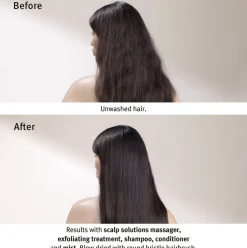 Scalp Solutions Stimulating Scalp Massager