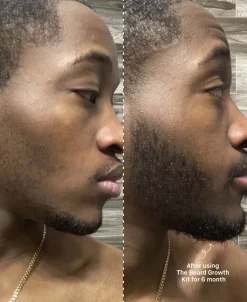 The Beard Growth Kit